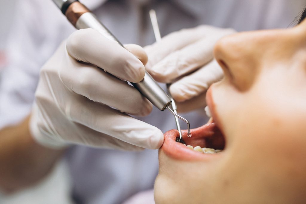 Woman patient at dentist tooth decay