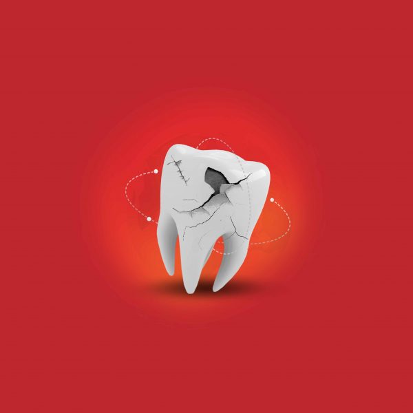 ฟันผุ ปรากฎการณ์ที่สร้างผลกระทบทั่วโลก